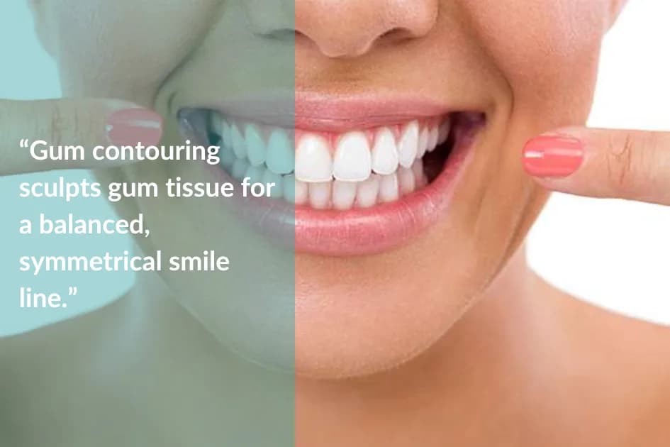 A patient receiving gum contouring with a dental laser.